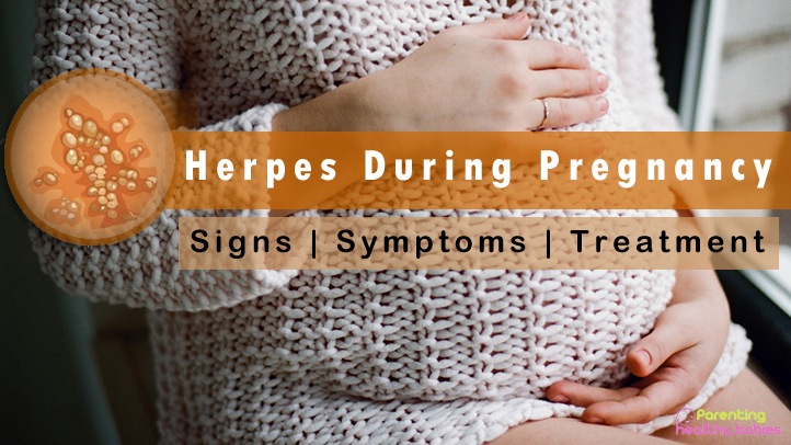 herpes during pregnancy