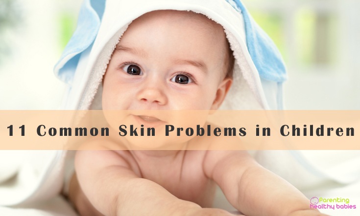 skin problems in children