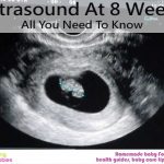 Ultrasound At 8 Weeks – All You Need To Know