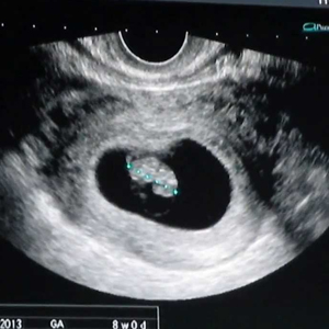 week 8 ultrasound
