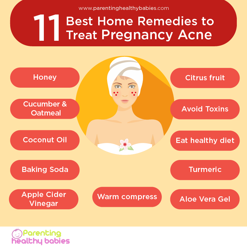 11 Natural Remedies To Treat Pregnancy Acne