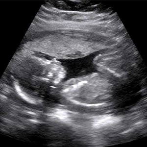 21 Tricks To Decoding An Ultrasound