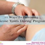 11 Ways to Preventing Varicose Veins During Pregnancy