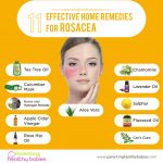 effective remedies for rosacea