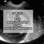 baby gender from sonogram