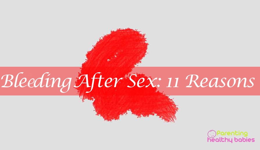 bleeding after sex
