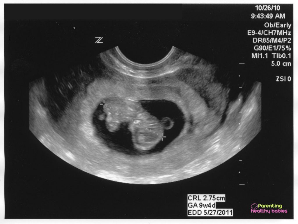week 9 ultrasound