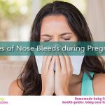 Pregnancy seems to be a roller coaster ride. Nosebleed is one of the experiences which are upsetting. Here are Causes of Nose Bleeds during Pregnancy.