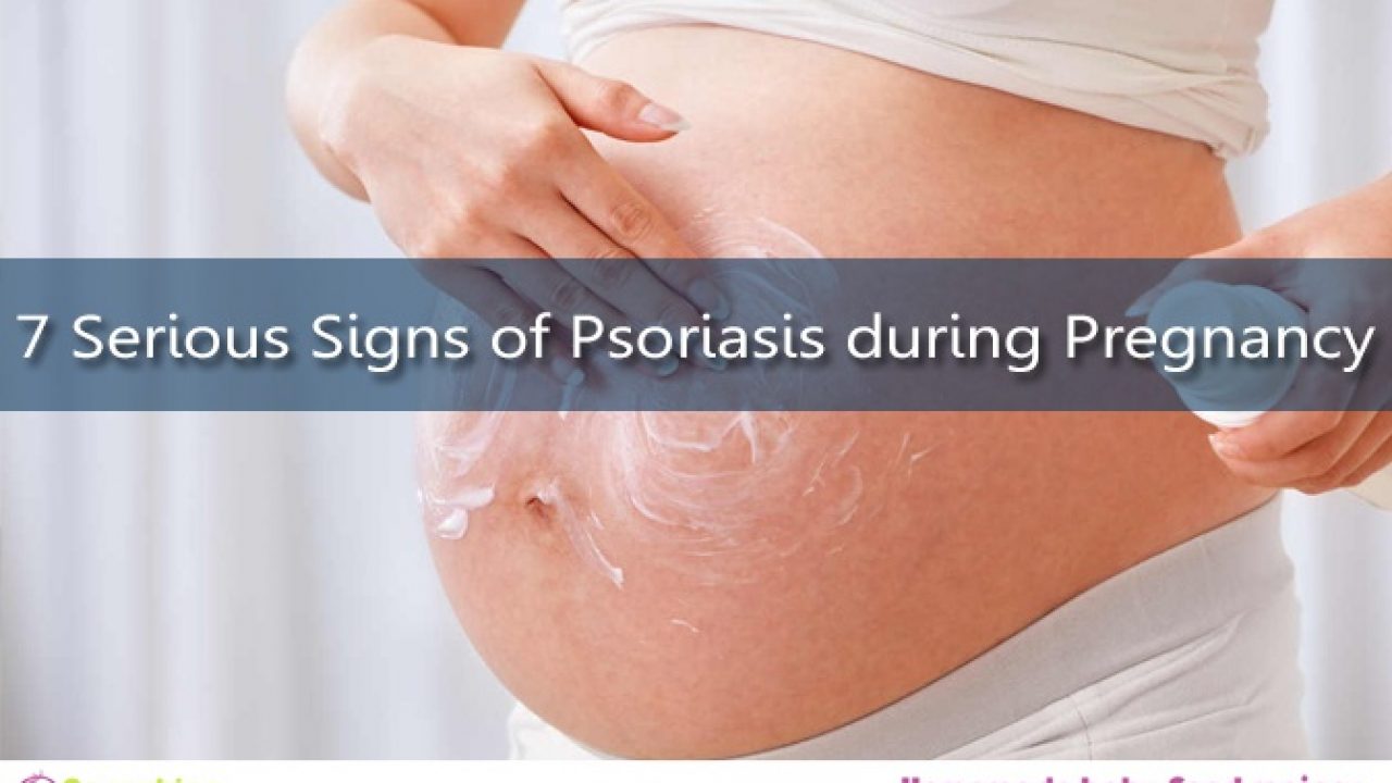 developed psoriasis during pregnancy hogyan lehet gyorsan enyhíteni a gyulladást pikkelysömörben