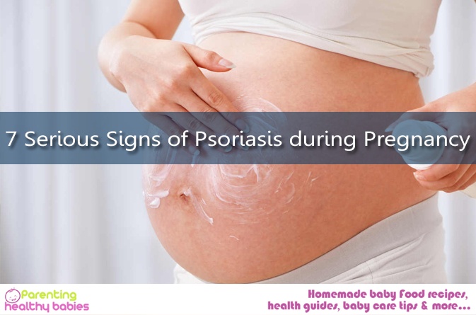 Psoriasis early pregnancy symptom