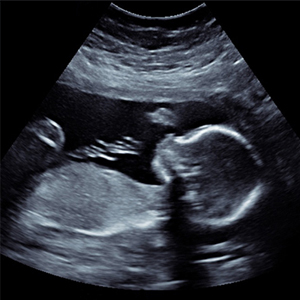 11 Do’s and Don’ts for Ultrasonography Every New Mom Should Know