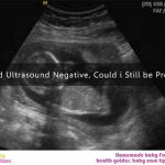 Upt and ultrasound negative, could i still be pregnant?