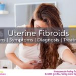 Uterine fibroids signs, symptoms, diagnosis and treatment: