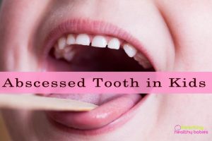 11 Natural Remedies to Treat Abscessed Tooth in Child