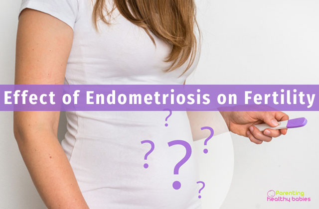 effect of endometriosis on fertility
