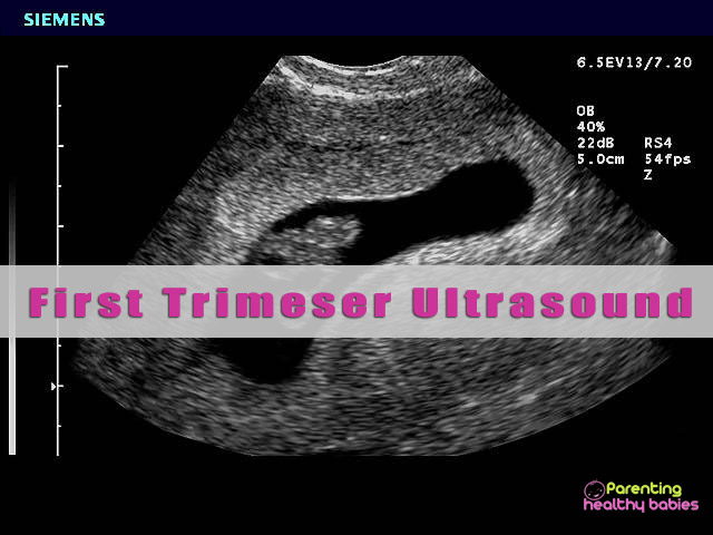 first trimester ultrasound scans