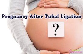 tubal ligation