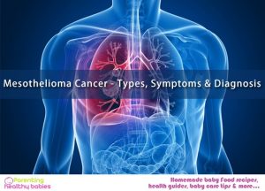 Mesothelioma Cancer - Types, Symptoms & Diagnosis