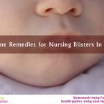 11 Home Remedies for Nursing Blisters In Babies