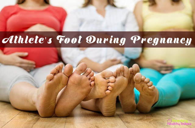 athlete's foot during pregnancy