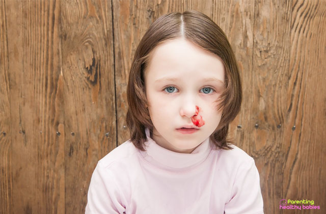 broken nose in children