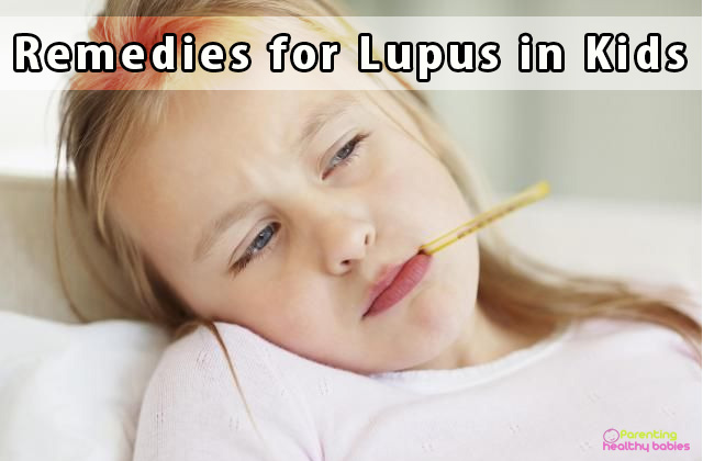 remedies for lupus in kids