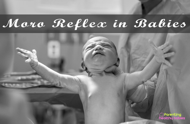 moro reflex in babies