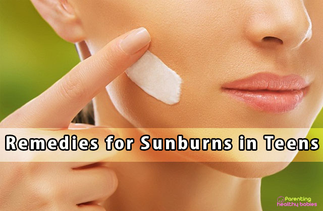 sunburns in teens