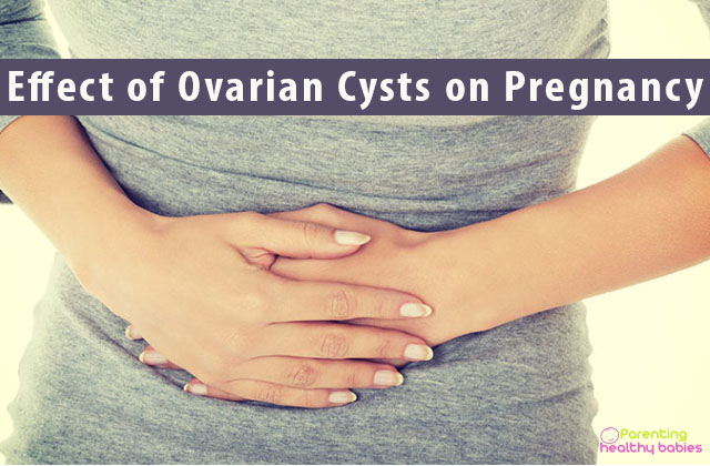 Effect of Ovarian Cysts on Pregnancy