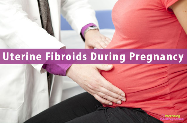 Uterine Fibroids During Pregnancy