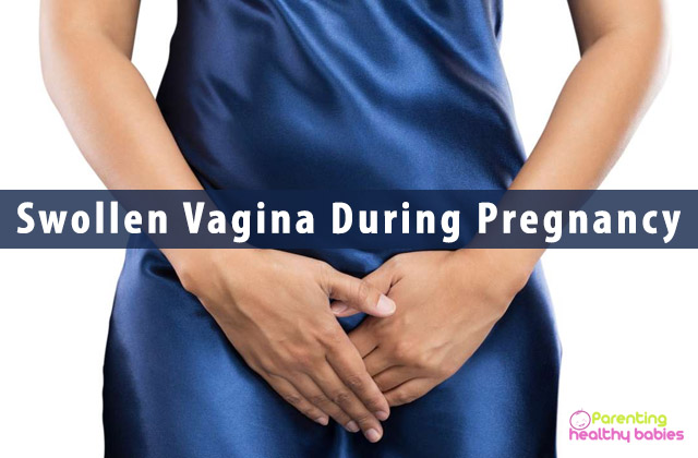 Swollen Vagina During Pregnancy