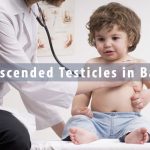 Undescended Testicles in Babies