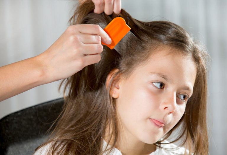 Head Lice Prevention 11 Things Every Parent Should Do
