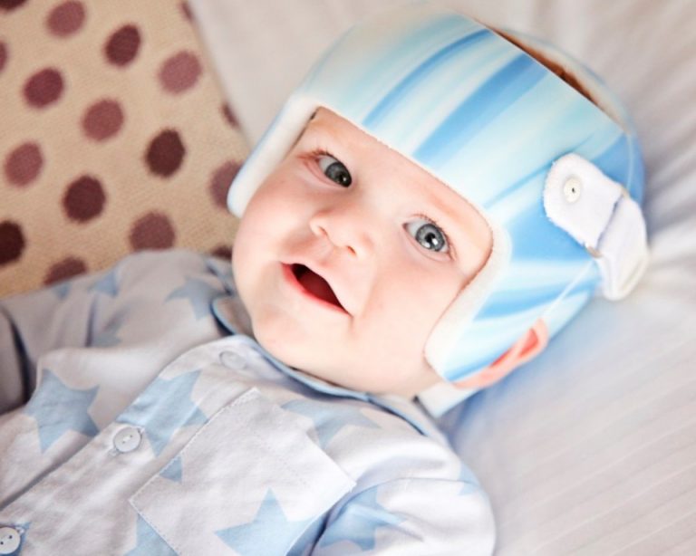 7 Ways to Prevent Plagiocephaly in Babies (Flat Head Syndrome)