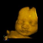 3d baby ultrasound