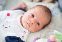 baby acne on face remedies