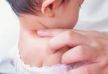 baby neck rash