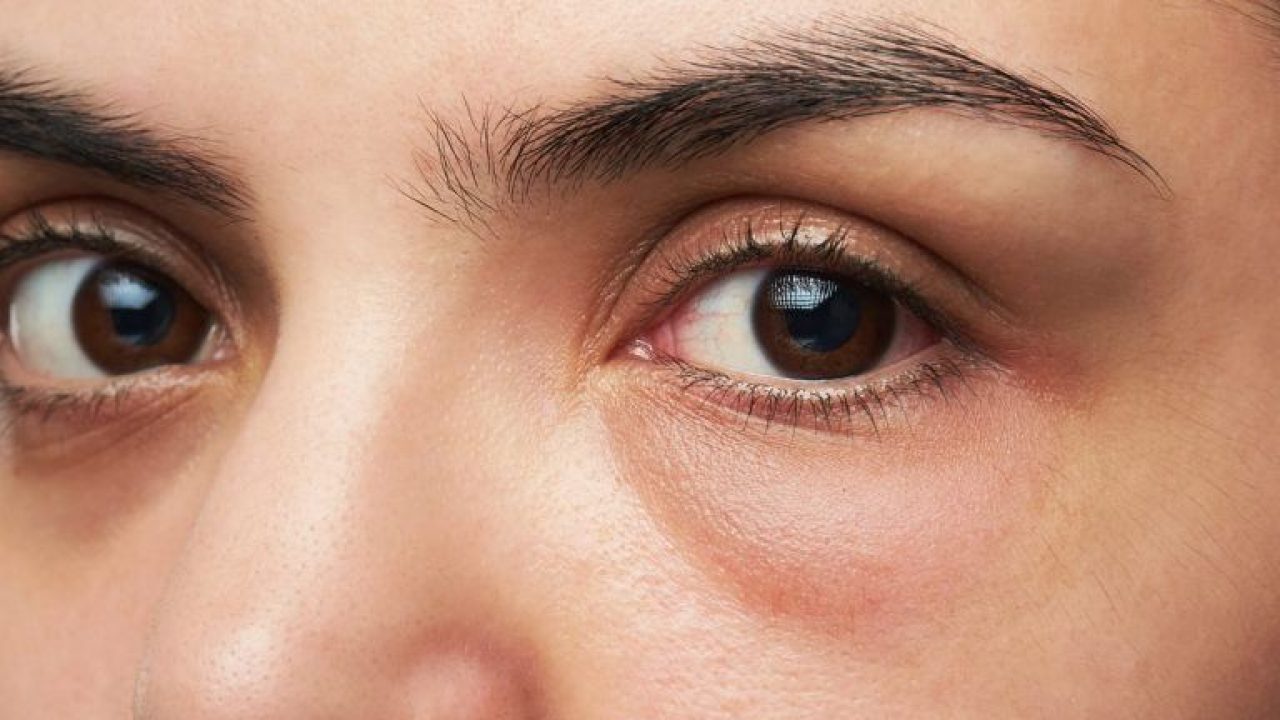 preparation h for puffy eyes