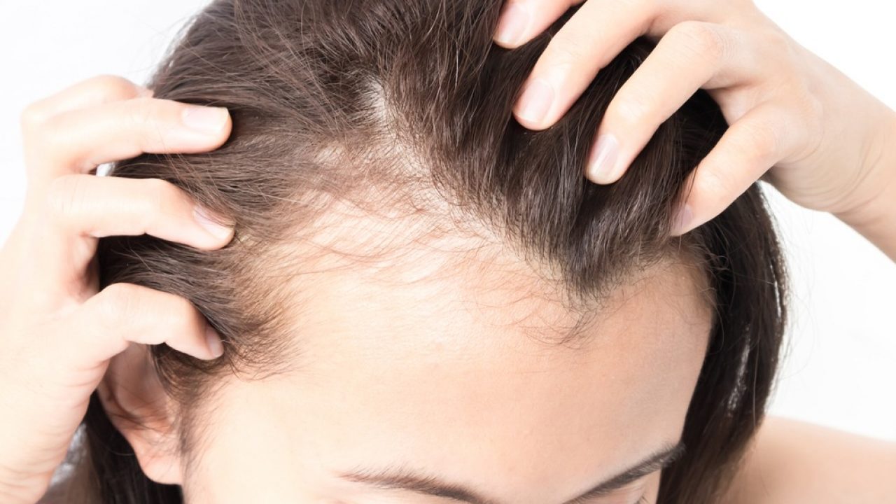 Postpartum Hair Loss: Causes and Remedies | Parentinghealthybabies