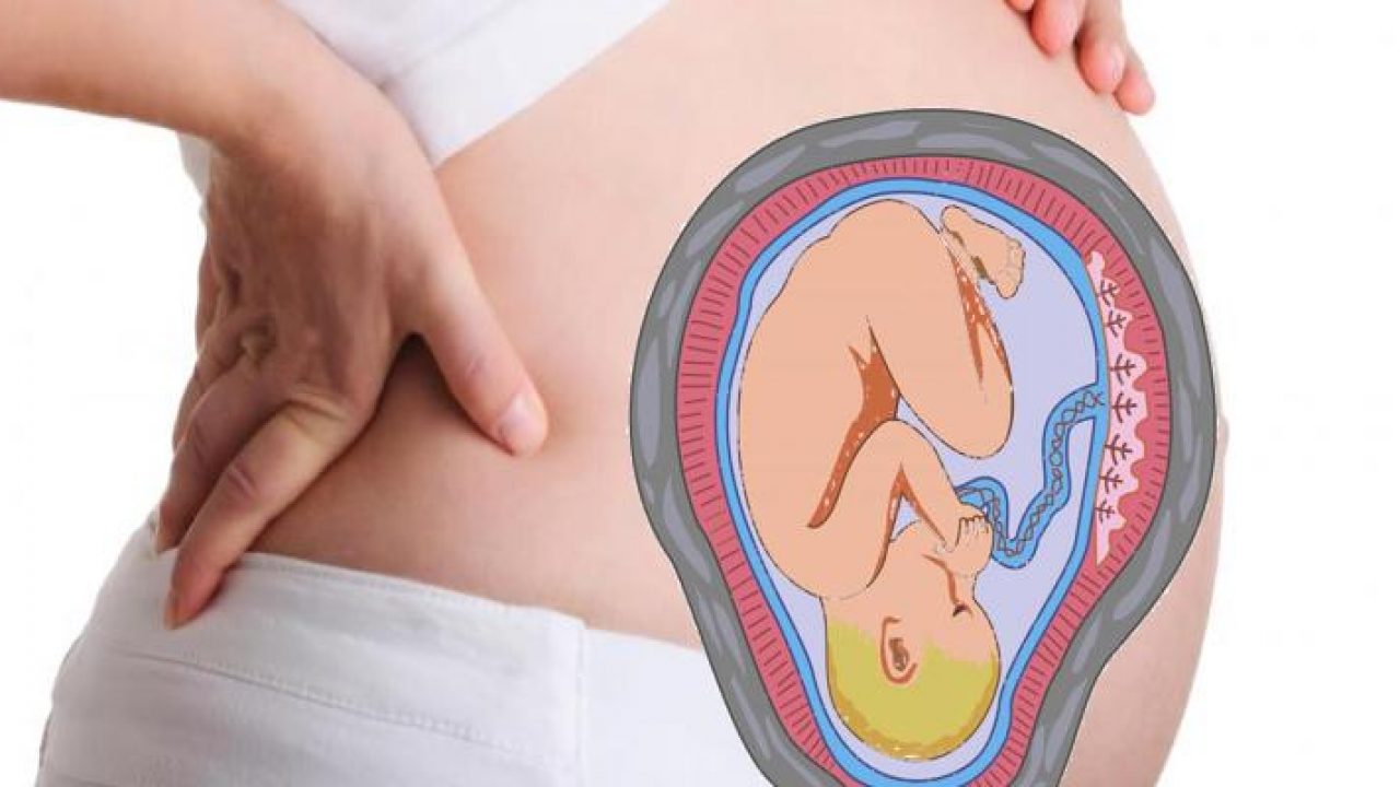 Retroverted uterus pregnancy complications