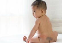 mongolian spot in babies