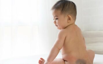 mongolian spot in babies