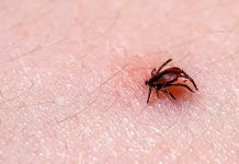 tick borne diseases