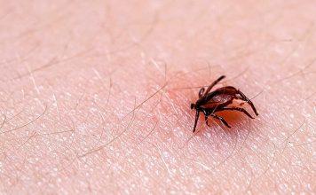 tick borne diseases