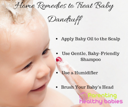 dandruff-in-babies-causes-symptoms-and-home-remedies