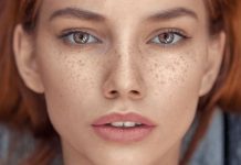 how to get rid of freckles