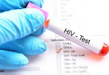 how to get tested for hiv