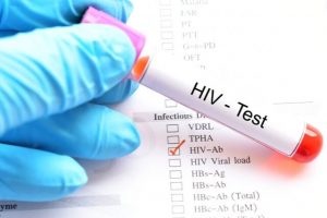 How to Get Tested for HIV? | Parentinghealthybabies.com