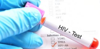 how to get tested for hiv