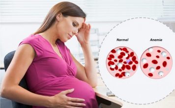 anemia during pregnancy